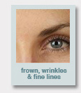 frown, wrinkles & fine lines