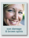 sun damage & brown spots