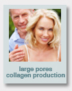 loose skin, large pores