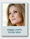saggy jowls