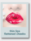 thin lips, flattened cheeks
