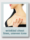 wrinkled chest lines, uneven tone