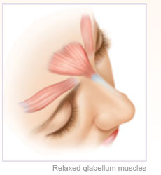 BOTOX® Cosmetic